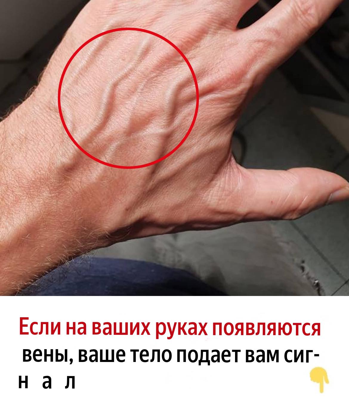 Когда следует беспокоиться о внезапно появляющихся венах ?